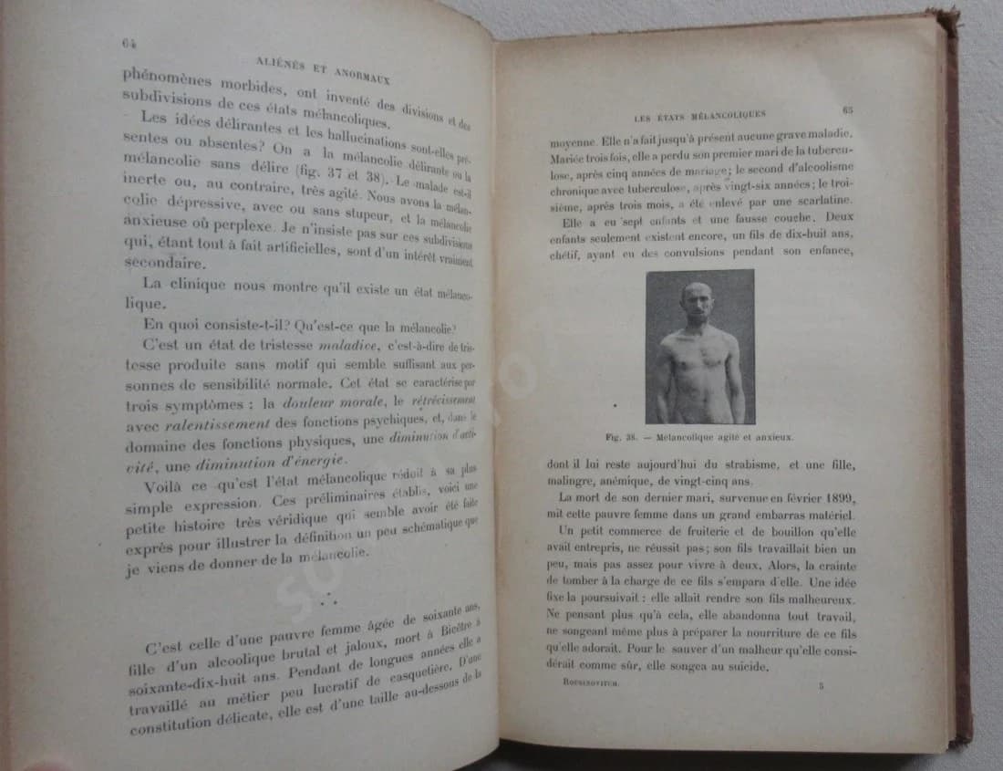 Aliénés et Anormaux. J ROUBINOVITCH - Image 5