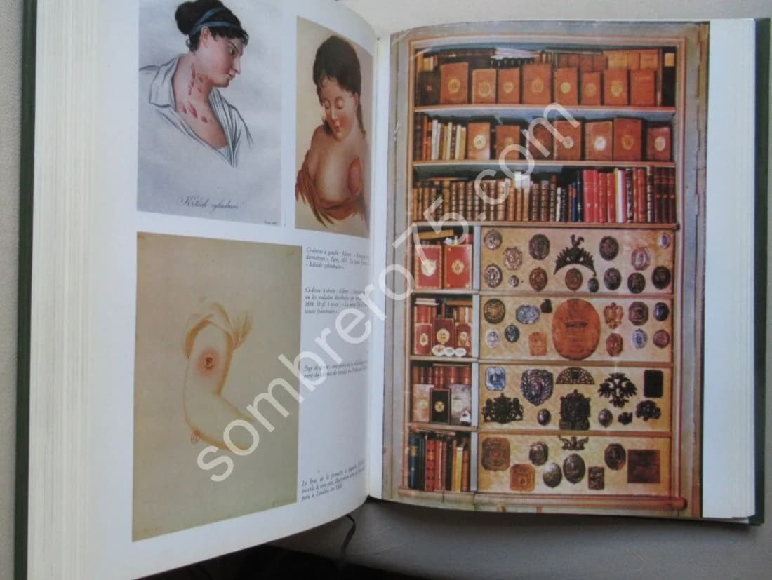 Les Livres Anciens de Médecine et de Pharmacie. Dr P A Créhange - Image 9