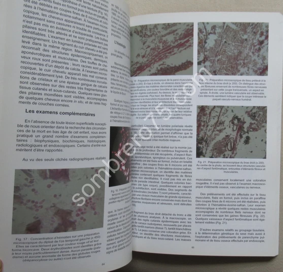 Maternité et Petite Enfance en Gaule Romaine. D. GOUREVITCH - Image 5