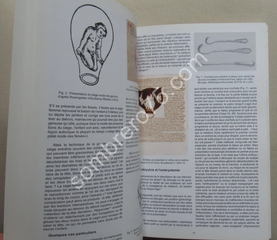 Maternité et Petite Enfance en Gaule Romaine. D. GOUREVITCH - Image 6