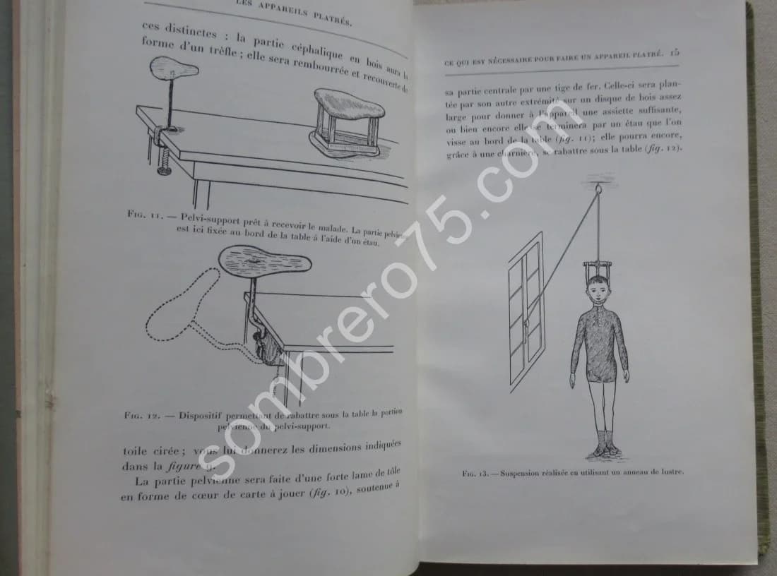 Les Appareils Platrés. - Dr Calot - Image 4