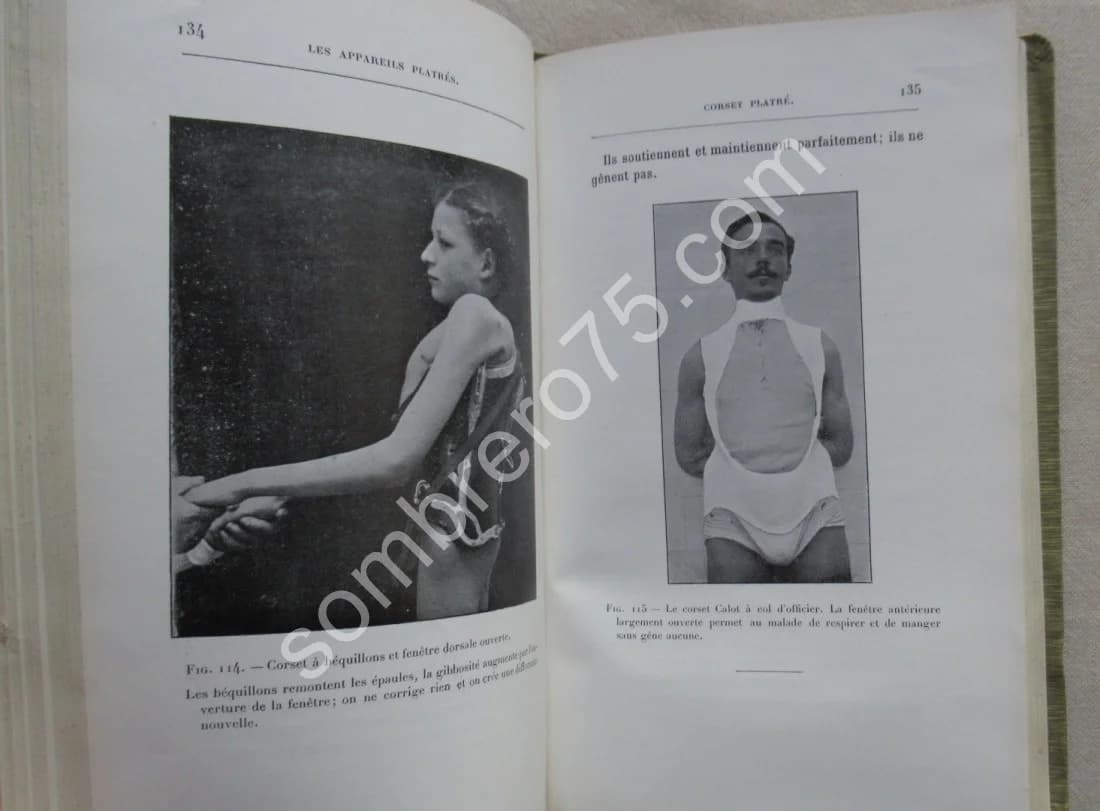 Les Appareils Platrés. - Dr Calot - Image 5