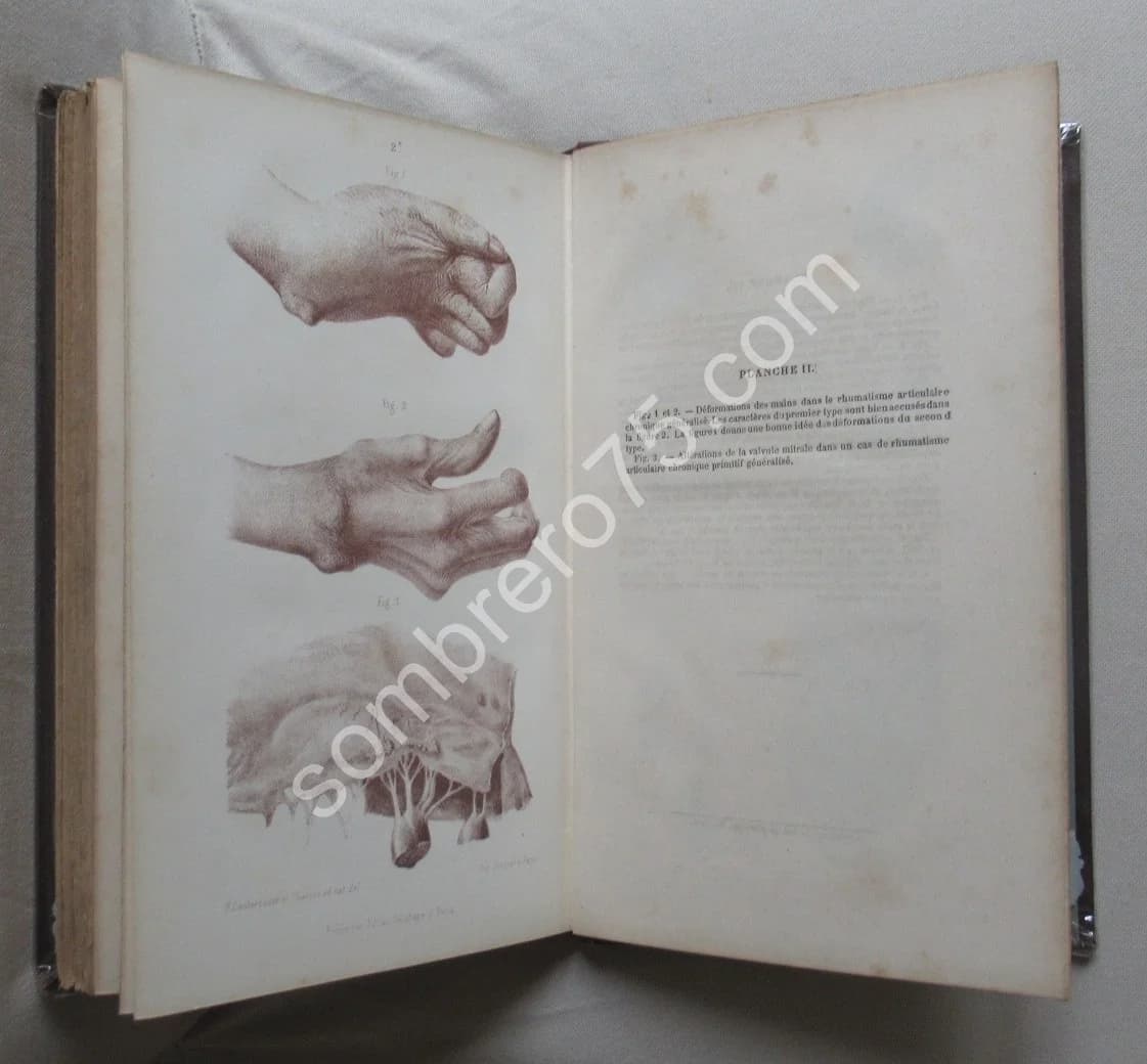 Leçons Cliniques sur les Vieillards et les Maladies Chroniques. J M CHARCOT - Image 5