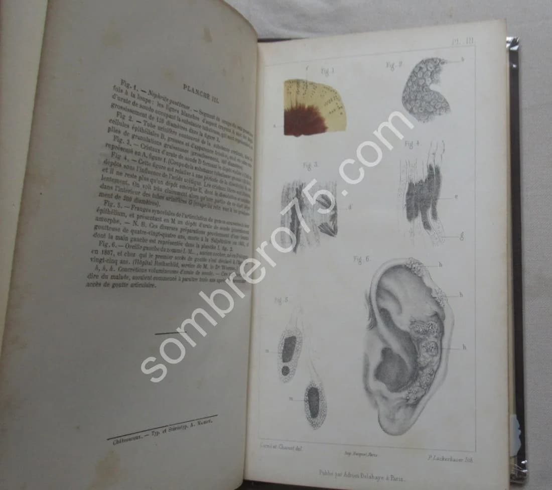 Leçons Cliniques sur les Vieillards et les Maladies Chroniques. J M CHARCOT - Image 7