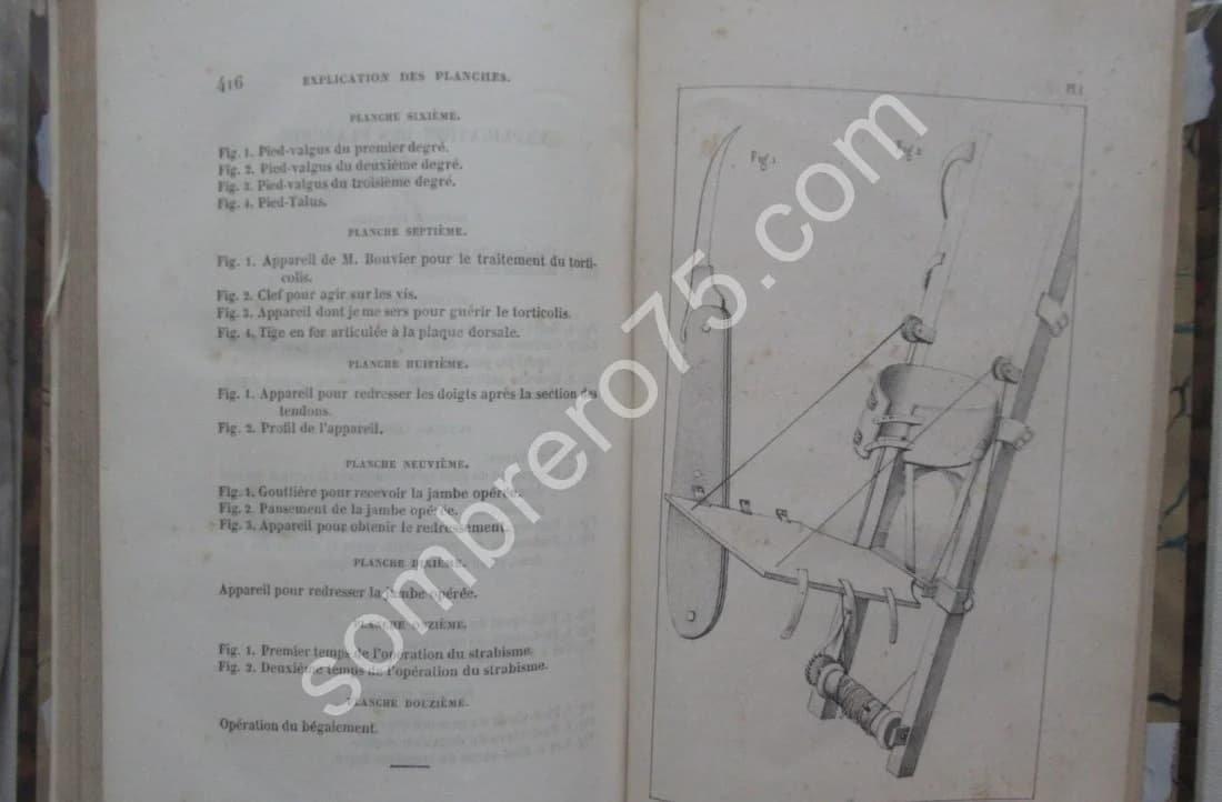 De la Ténotomie sous Cutanée - Dr Phillips. 1841 - Image 9