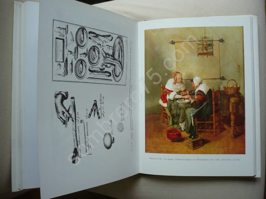 La Chirurgie Moderne : Ses Débuts en Occident, XVIe, XVIIe, XVIIIe Siècles. Mirko Drazen Grmek - Image 5