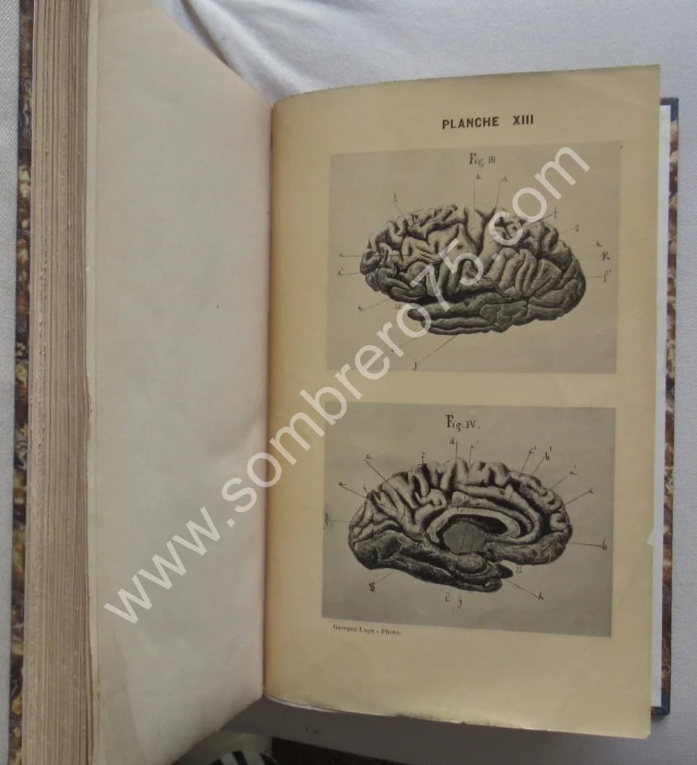 Leçons Cliniques sur les principaux Phénomènes de l'Hypnotisme - Image 6