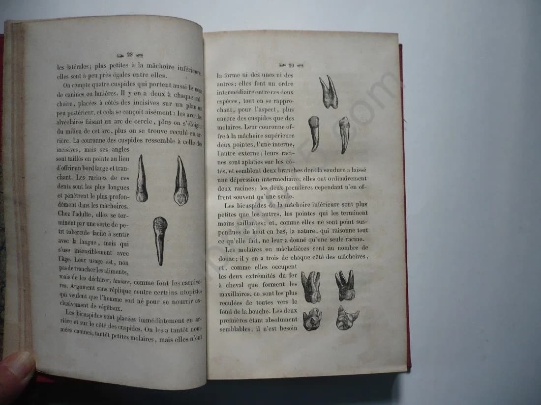 Nouveau Traité Théorique et Pratique de l'Art du Dentiste. 1841 - Image 4